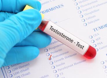 Examen de Testosterona